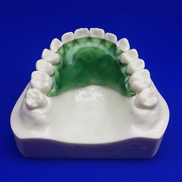 Hawley Retainer 3 Hawley Retainer