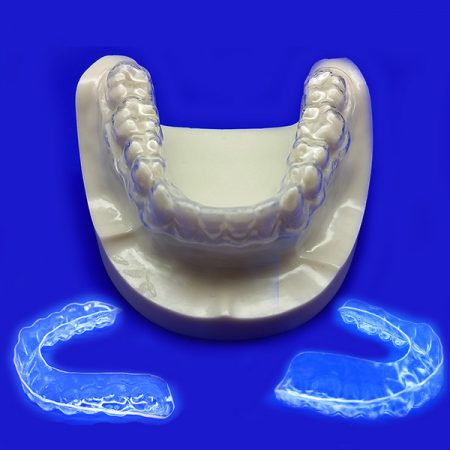 Clear Aligners